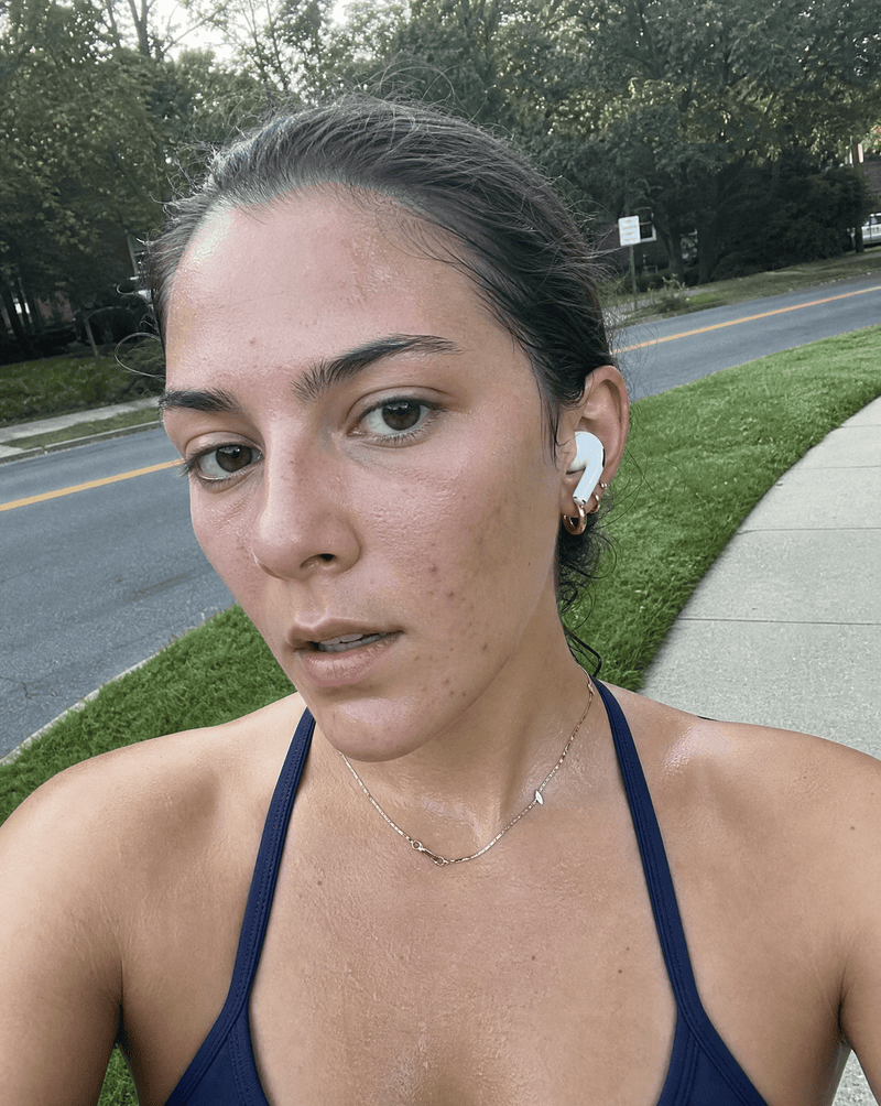 Working Out and Acne: What Helps, What Hurts, and How to Protect Your Skin - Omora Beauty Lab