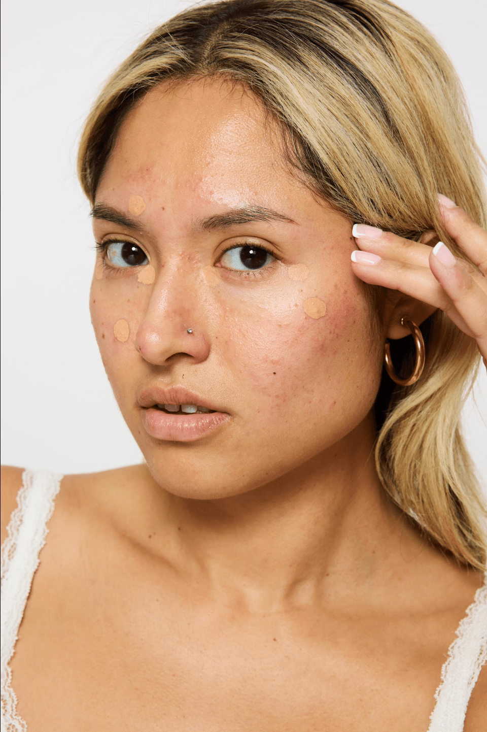 How to Choose a Concealer for Acne-Prone and Sensitive Skin - Omora Beauty Lab